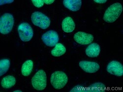 CoraLite Plus 488-conjugated MCM4 Mouse Monoclonal Antibody, Proteintech:Antibodies:Primary