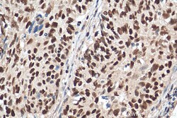 MCM6 Mouse Monoclonal Antibody, Proteintech Unconjugated; 150 &mu;L:Antibodies,