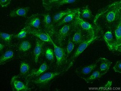 MCOLN1 Rabbit Polyclonal Antibody, Proteintech Unconjugated; 150 &mu;L:Antibodies,