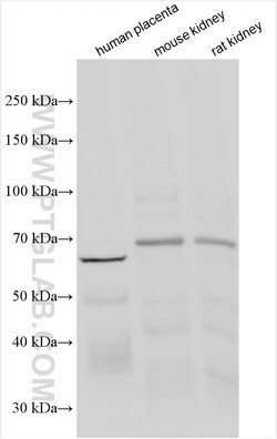 MCOLN1 Rabbit Polyclonal Antibody, Proteintech Unconjugated; 150 &mu;L:Antibodies,