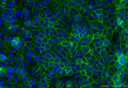 CoraLite Plus 488-conjugated MCT4 Rabbit Polyclonal Antibody, Proteintech:Antibodies:Primary