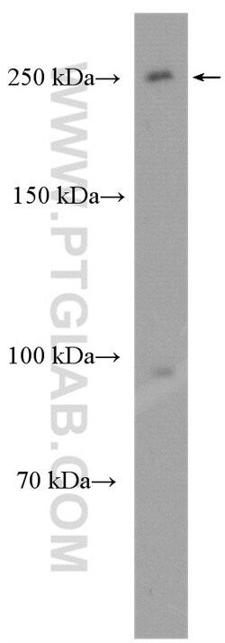 MDC1 Rabbit Polyclonal Antibody, Proteintech Unconjugated; 20 &mu;L:Antibodies,