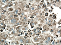 ME2 Mouse Monoclonal Antibody, Proteintech:Antistoffer:Primære antistoffer