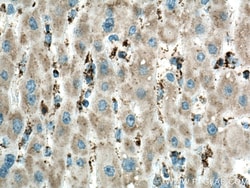 ME2 Mouse Monoclonal Antibody, Proteintech:Antistoffer:Primære antistoffer