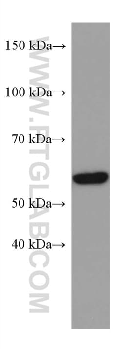 ME2 Mouse Monoclonal Antibody, Proteintech:Antistoffer:Primære antistoffer