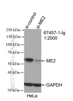 ME2 Mouse Monoclonal Antibody, Proteintech:Antistoffer:Primære antistoffer