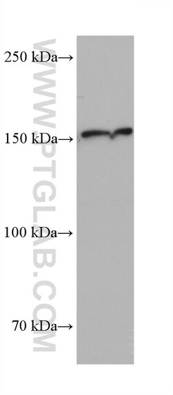 MED23 Mouse Monoclonal Antibody, Proteintech Unconjugated; 150 &mu;L:Antibodies,