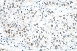 MED4 Mouse Monoclonal Antibody, Proteintech Unconjugated; 20 &mu;L:Antibodies,