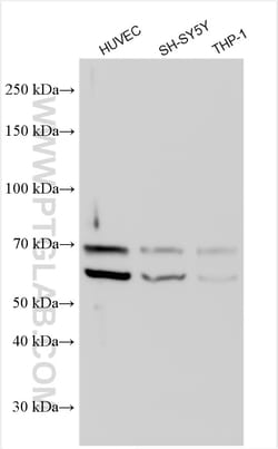 MEF2A Rabbit Polyclonal Antibody, Proteintech Unconjugated; 150 &mu;L:Antibodies,