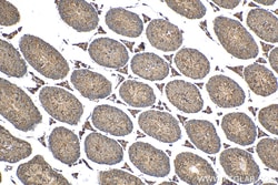 MEI4 Rabbit Polyclonal Antibody, Proteintech:Antibodies:Primary Antibodies