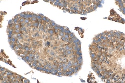 MEI4 Rabbit Polyclonal Antibody, Proteintech:Antibodies:Primary Antibodies