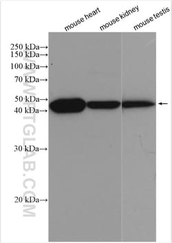 MEI4 Rabbit Polyclonal Antibody, Proteintech:Antibodies:Primary Antibodies