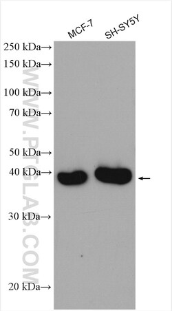 METTL2 Rabbit Polyclonal Antibody, Proteintech Unconjugated; 150 &mu;L:Antibodies,