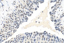 METTL3 Rabbit Polyclonal Antibody, Proteintech:Antibodies:Primary Antibodies