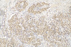 METTL3 Rabbit Polyclonal Antibody, Proteintech:Antibodies:Primary Antibodies