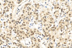 METTL3 Rabbit Polyclonal Antibody, Proteintech:Antibodies:Primary Antibodies
