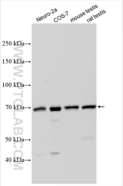 METTL3 Rabbit Polyclonal Antibody, Proteintech:Antibodies:Primary Antibodies
