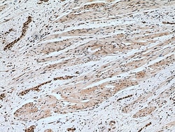 METTL3 Mouse Monoclonal Antibody, Proteintech Unconjugated; 20 &mu;L:Antibodies,