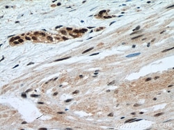 METTL3 Mouse Monoclonal Antibody, Proteintech Unconjugated; 20 &mu;L:Antibodies,