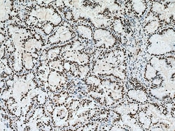 METTL3 Mouse Monoclonal Antibody, Proteintech Unconjugated; 20 &mu;L:Antibodies,