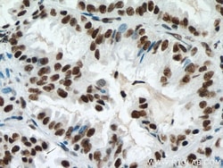 METTL3 Mouse Monoclonal Antibody, Proteintech Unconjugated; 20 &mu;L:Antibodies,