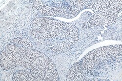 METTL3 Mouse Monoclonal Antibody, Proteintech Unconjugated; 20 &mu;L:Antibodies,