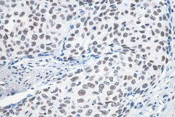 METTL3 Mouse Monoclonal Antibody, Proteintech Unconjugated; 20 &mu;L:Antibodies,