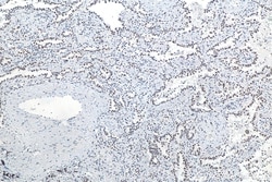 METTL3 Mouse Monoclonal Antibody, Proteintech Unconjugated; 20 &mu;L:Antibodies,