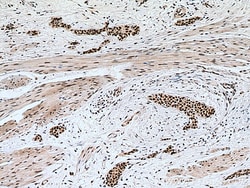 METTL3 Mouse Monoclonal Antibody, Proteintech:Antibodies:Primary Antibodies