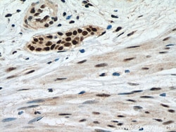 METTL3 Mouse Monoclonal Antibody, Proteintech:Antibodies:Primary Antibodies