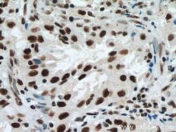 METTL3 Mouse Monoclonal Antibody, Proteintech:Antibodies:Primary Antibodies
