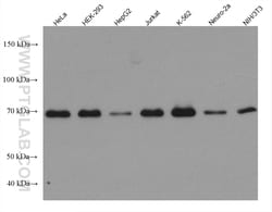 METTL3 Mouse Monoclonal Antibody, Proteintech:Antibodies:Primary Antibodies