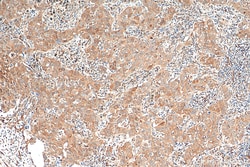 METTL6 Mouse Monoclonal Antibody, Proteintech 20 &mu;L | Buy Online | Proteintech | Fisher Scientific