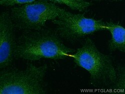 MICAL1 Mouse Monoclonal Antibody, Proteintech:Antibodies:Primary Antibodies