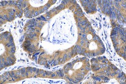 MMP14 / MT1-MMP Rabbit Polyclonal Antibody, Proteintech Unconjugated; 20