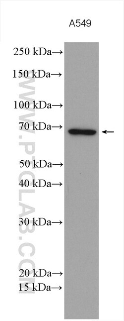 MMP14 / MT1-MMP Rabbit Polyclonal Antibody, Proteintech Unconjugated; 20