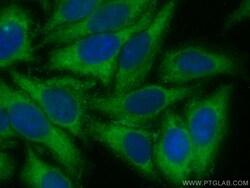 CoraLite Plus 488-conjugated MMP14 / MT1-MMP Rabbit Polyclonal Antibody,