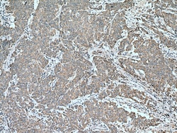MMP17 Rabbit Polyclonal Antibody, Proteintech Unconjugated; 150 &mu;L:Antibodies,