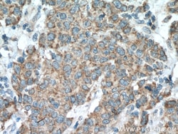 MMP17 Rabbit Polyclonal Antibody, Proteintech Unconjugated; 150 &mu;L:Antibodies,