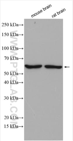MMP17 Rabbit Polyclonal Antibody, Proteintech Unconjugated; 150 &mu;L:Antibodies,