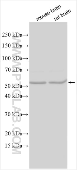 MMP24 Rabbit Polyclonal Antibody, Proteintech:Antibodies:Primary Antibodies