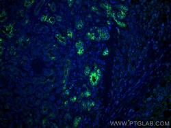 MMP7 Mouse Monoclonal Antibody, Proteintech Unconjugated; 20 &mu;L:Antibodies,