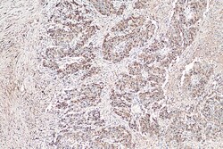 MMP7 Mouse Monoclonal Antibody, Proteintech Unconjugated; 20 &mu;L:Antibodies,