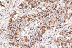 MMP7 Mouse Monoclonal Antibody, Proteintech Unconjugated; 20 &mu;L:Antibodies,