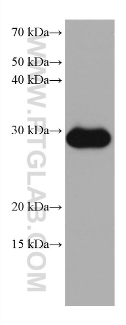 MMP7 Mouse Monoclonal Antibody, Proteintech Unconjugated; 20 &mu;L:Antibodies,