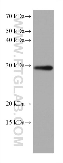MMP7 Mouse Monoclonal Antibody, Proteintech Unconjugated; 20 &mu;L:Antibodies,