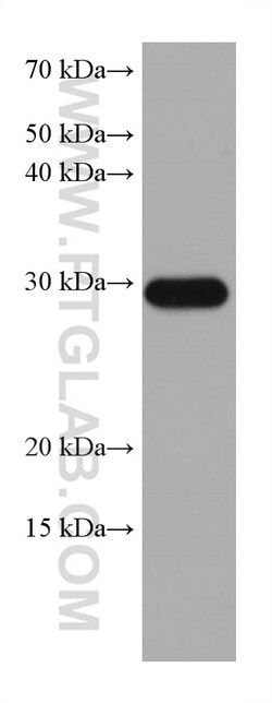 MMP7 Mouse Monoclonal Antibody, Proteintech Unconjugated; 20 &mu;L:Antibodies,