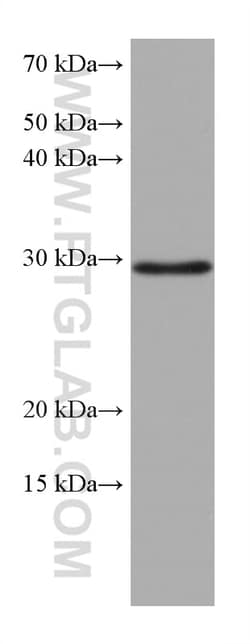 MMP7 Mouse Monoclonal Antibody, Proteintech Unconjugated; 20 &mu;L:Antibodies,