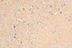 MOAP1 Rabbit Polyclonal Antibody, Proteintech Unconjugated; 150 &mu;L:Antibodies,