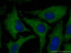 MOCS2 Mouse Monoclonal Antibody, Proteintech Unconjugated; 150 &mu;L:Antibodies,